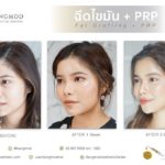 “New Modern Facelift 2021” บอกลาปัญหาเหี่ยวย่น ด้วย 3 เทคนิคศัลยกรรม เพื่อใบหน้าอ่อนเยาว์อย่างเป็นธรรมชาติ