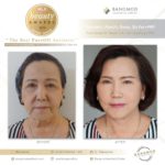 “New Modern Facelift 2021” บอกลาปัญหาเหี่ยวย่น ด้วย 3 เทคนิคศัลยกรรม เพื่อใบหน้าอ่อนเยาว์อย่างเป็นธรรมชาติ