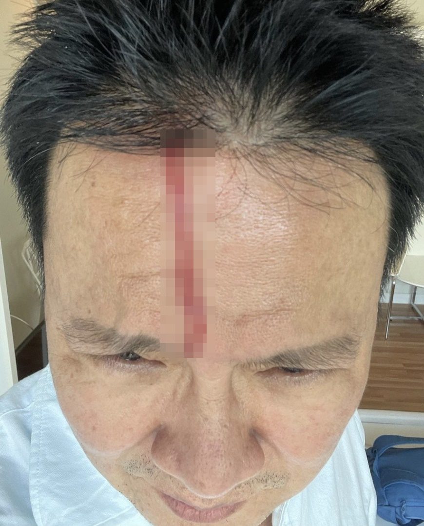 ลุงรงค์ หัวแตก ไม่ให้ปลอบใจ