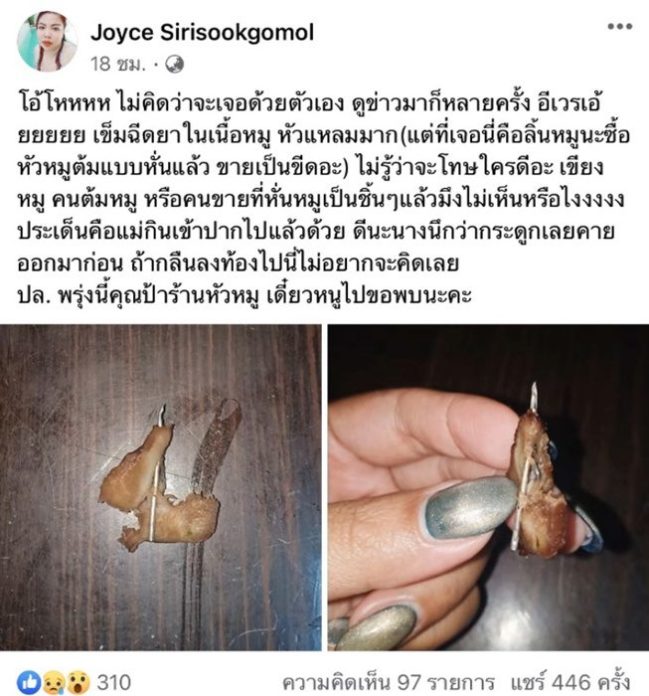 สาวเปิดใจ แม่เคี้ยวเนื้อหมูเจอเข็มคา คาดใช้ฉีดหมูปนมากับหัว