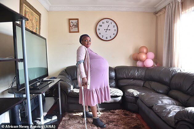 Woman Claims She Gave Birth To 10 Twins And Was Sent To A Psychiatrist After The Husband Did Not Believe Found The Dubious Thong Thip Newsdir3