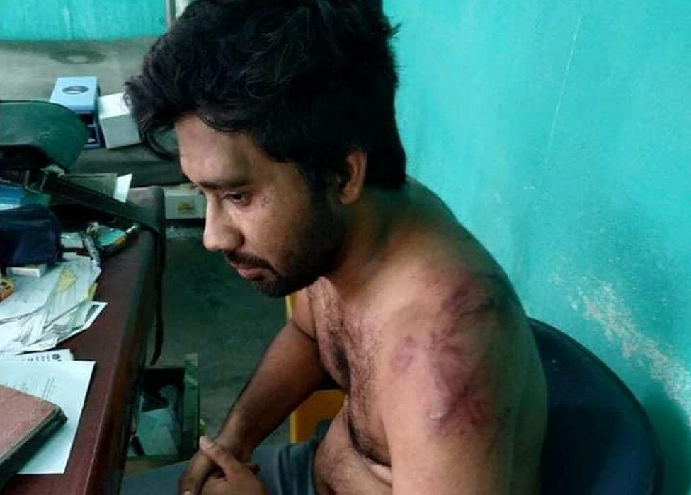 An injured Dr Senapati