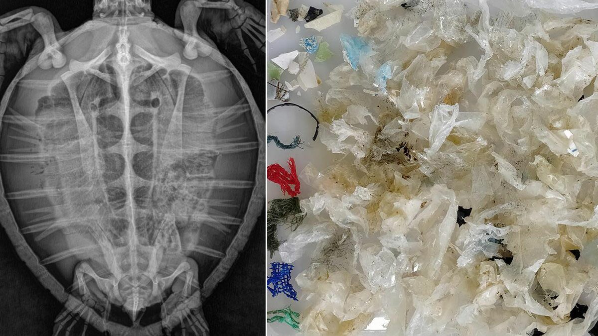 เต่าตนุ กินขยะในทะเลเข้าไป 158 ชิ้น น้ำหนักรวม 60 กรัม หมอเร่งช่วย