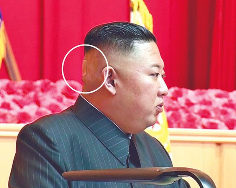 “ติดพลาสเตอร์” อันเบิ้มที่หัว แหล่งข่าวชี้ไม่น่าวิตก