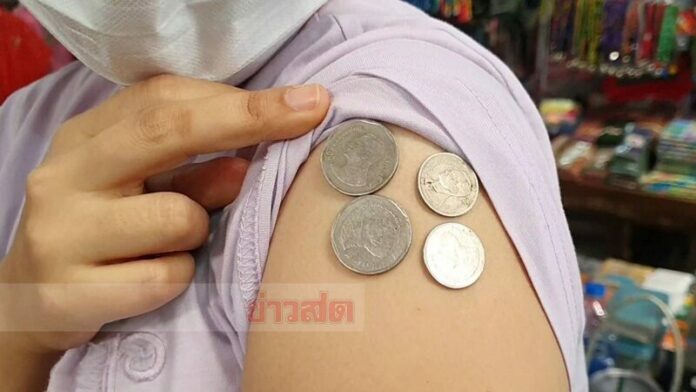 แขนดูดเหรียญ
