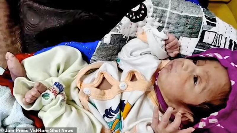แม่อินเดียวัย 70 ปี “คลอดลูกคนแรก”