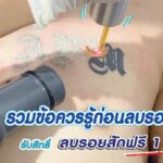 ก่อนเลเซอร์ลบรอยสักควรรู้อะไร? ทำกี่ครั้งเห็นผล? ใครบ้างที่เหมาะกับวิธีนี้?