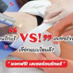 เลเซอร์ขนรักแร้ กำจัดขนหายจริง ทำแล้วไม่เจ็บ ต้องเครื่องเลเซอร์แบบไหนถึงจะดี