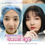 ตาใหม่ลุคหวานฉ่ำ! สกาย คลินิก เปิดเทคนิคเฉพาะ Sweet Eyes แก้จบหมดทุกปัญหาดวงตา