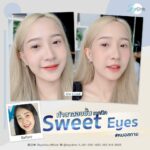 ตาใหม่ลุคหวานฉ่ำ! สกาย คลินิก เปิดเทคนิคเฉพาะ Sweet Eyes แก้จบหมดทุกปัญหาดวงตา
