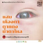 4 สัญญาณเตือนจากร่างกาย ให้ระวังฝุ่น PM 2.5