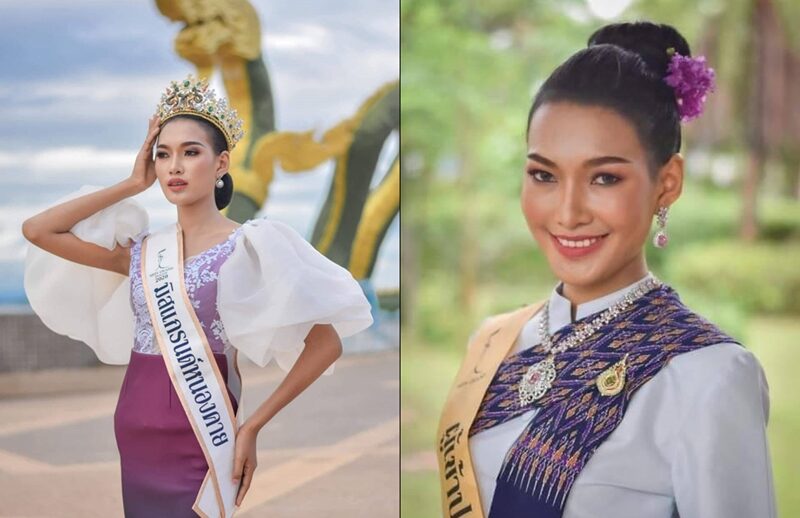 แม่ เผย อาการล่าสุด อาร์กี้ มิสแกรนด์ หลังประสบอุบัติเหตุรถชนบาดเจ็บสาหัส ขาหัก 3 ท่อน กระดูกโผล่ เบ้าตาแตก