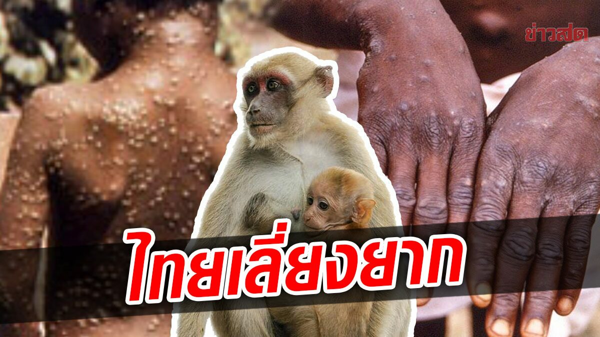 หมอธีระวัฒน์ ชี้ไทยอาจเผชิญกับการแพร่ระบาด ของโรค 'ฝีดาษลิง'