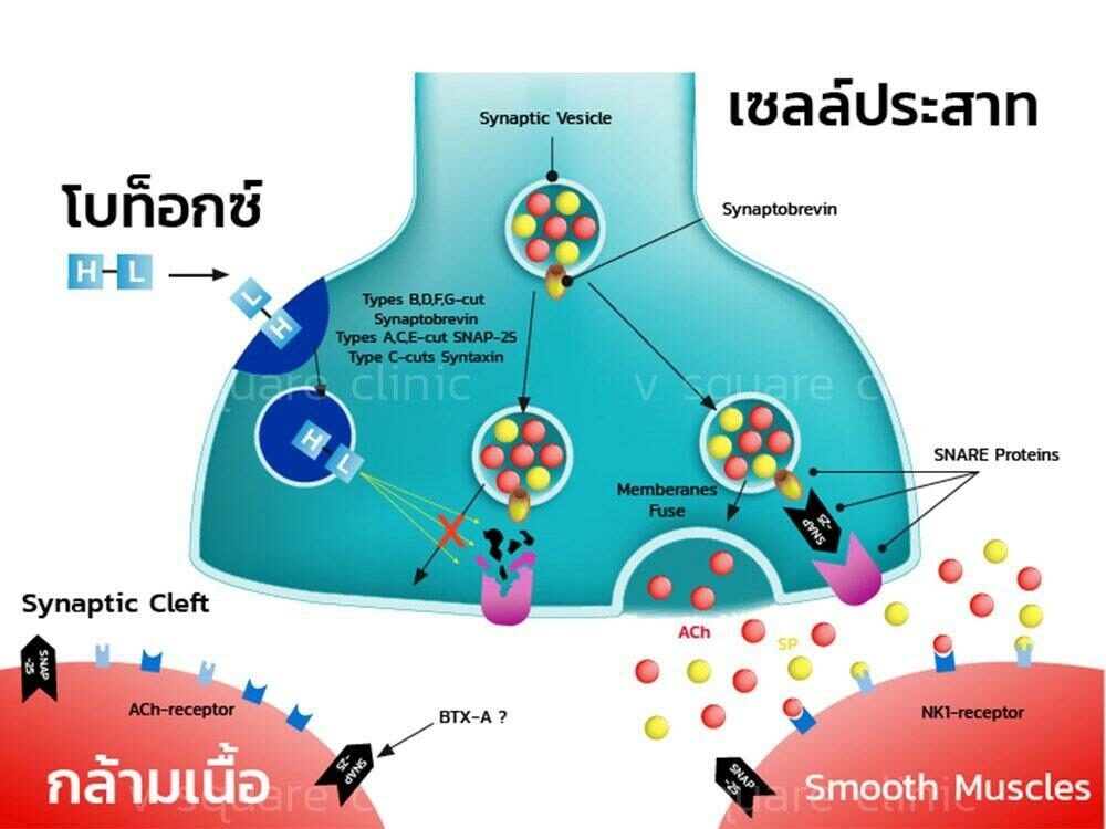การทำงานของโบท็อก