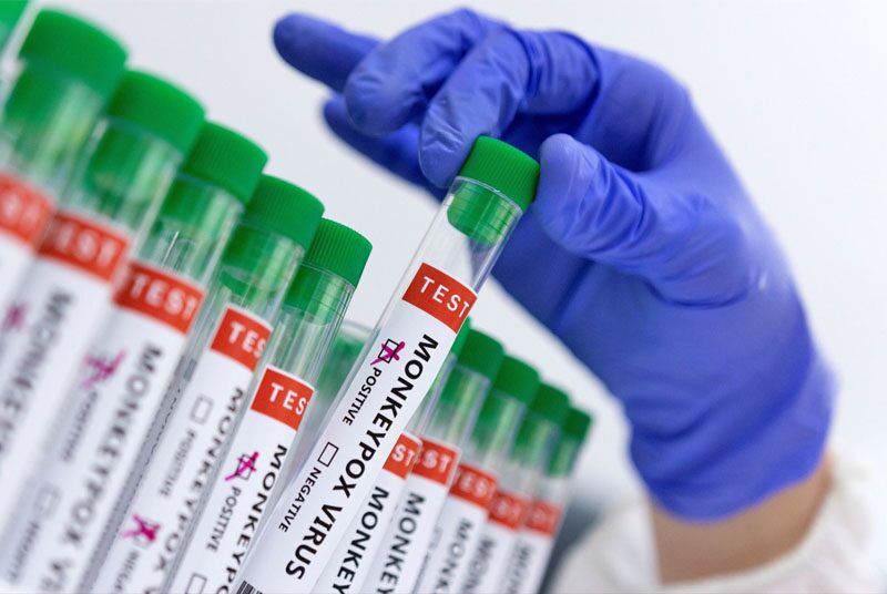download monkey pox quarantine download monkey pox quarantine
