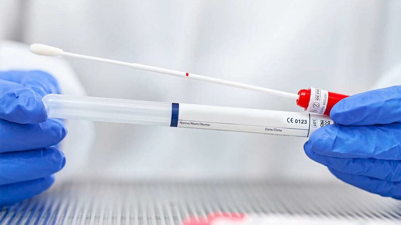 ทางเลือกใหม่ ตรวจคัดกรองมะเร็งปากมดลูก HPV DNA แบบเก็บตัวอย่างด้วย