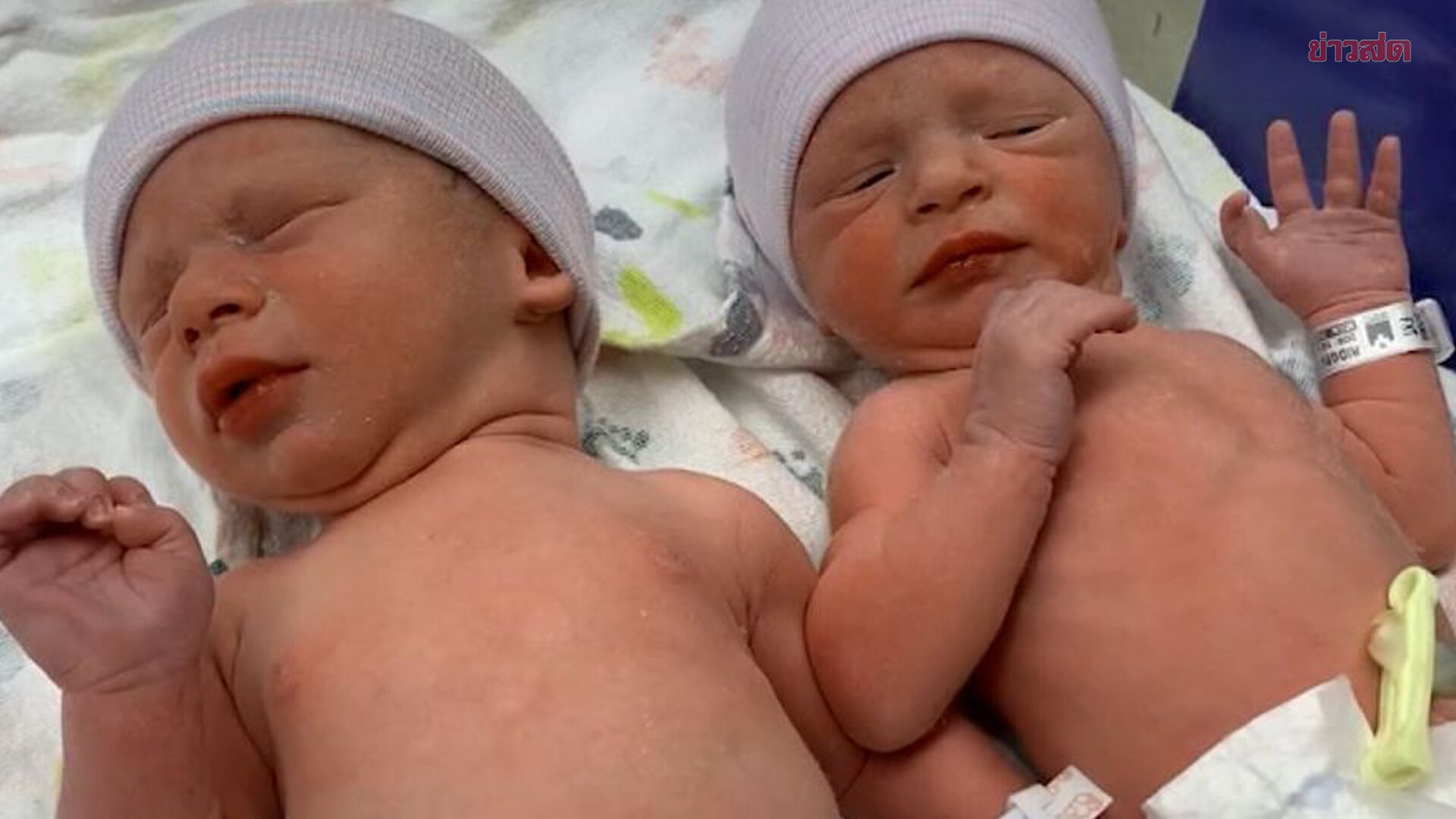 Ребенок родился в америке. Родившие близнецов. Близнецы период рождения.