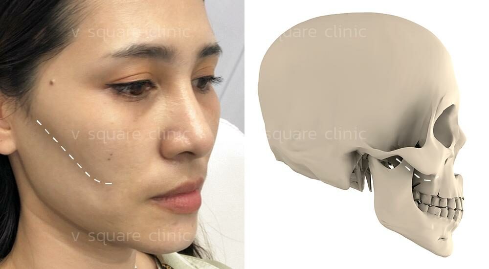 ปัญหาแก้มตอบ