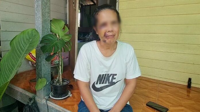 ทุบหน้า