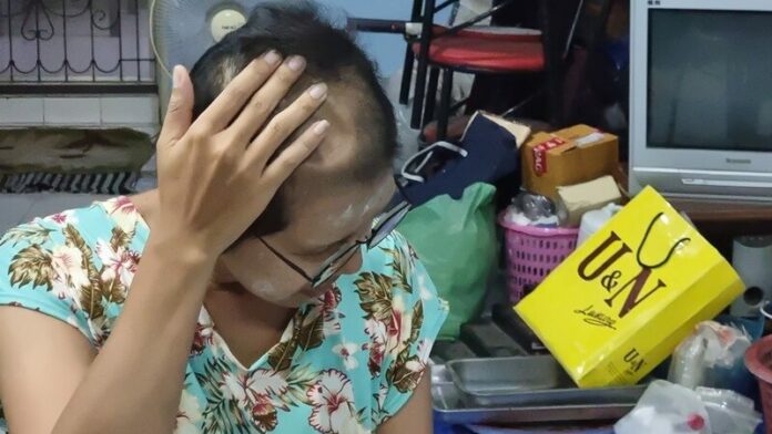 ตัดกะโหลก