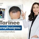 ฉีด PRP ผมการปลูกผมแบบธรรมชาติ