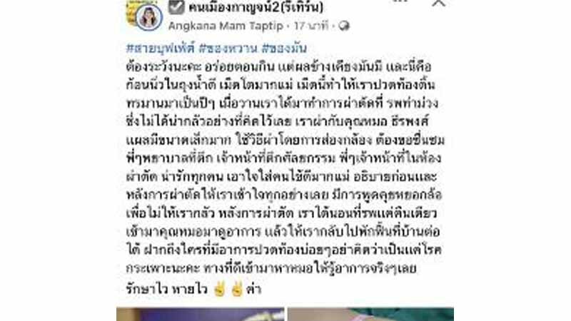 สายบุฟเฟต์ระวัง! สาวปวดท้องบ่อย ไม่พบสาเหตุ สุดท้ายกลายเป็นนิ่วในถุงน้ำดี - ข่าวสด สายบุฟเฟต์ระวัง! สาวปวดท้องบ่อย ไม่พบสาเหตุ สุดท้ายกลายเป็นนิ่วในถุงน้ำดี - ข่าวสด