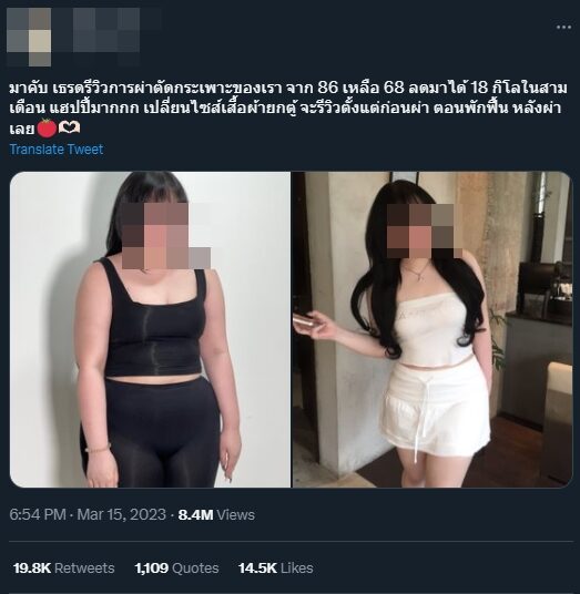 รีวิวตัดกระเพาะ