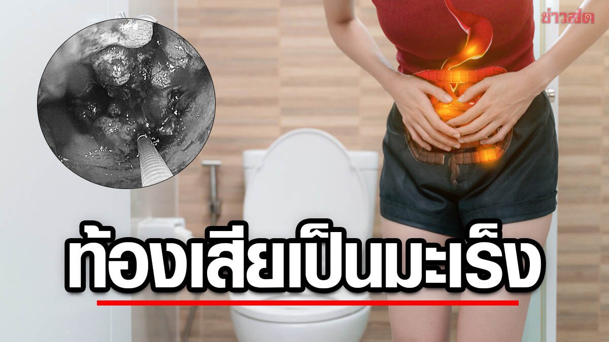 Man with chronic diarrhea for half a year Shock with intestinal