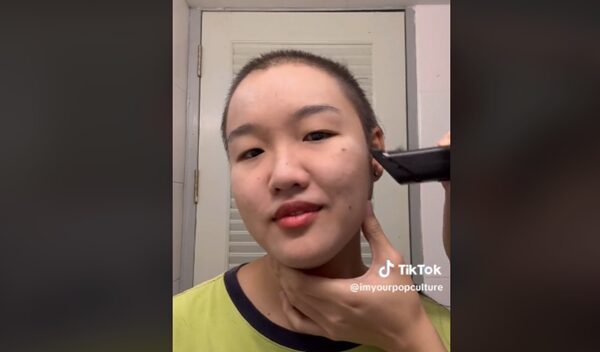 สาวป่วยเป็น โรคดึงผมตัวเอง แห่ให้กำลังใจล้นหลาม แฟนหนุ่มโกนผมเป็นเพื่อนด้วย เผย ช่วงที่ไม่กล้าออกจากบ้าน
