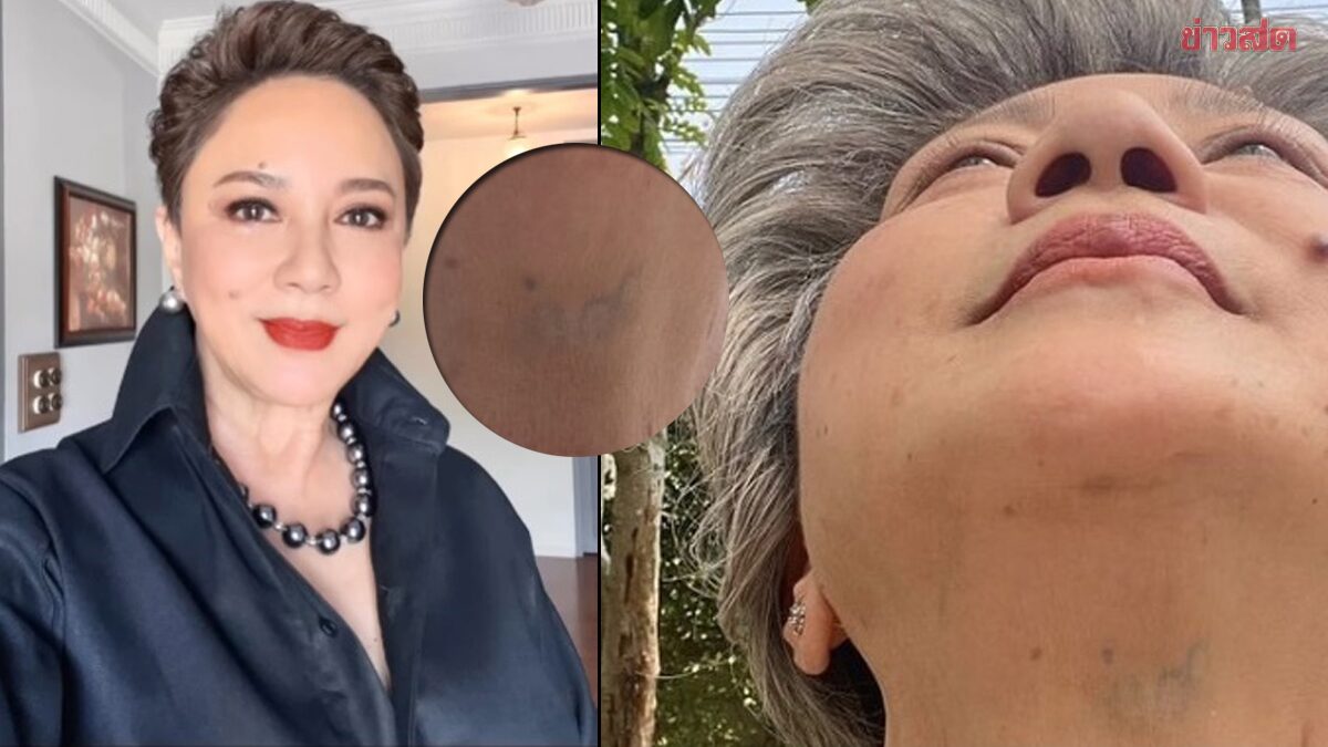 ตุ๊ก ดวงตา โดนสั่งให้ลบรอยสัก งงเส้นเลือดขึ้นเป็นเลข แห่ตีหวยกันใหญ่