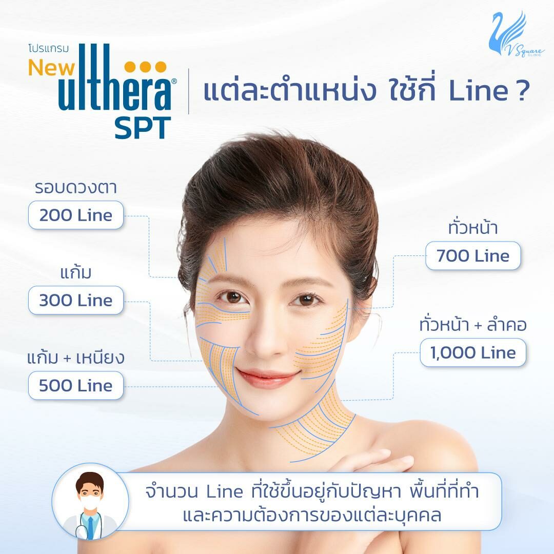 Ulthera ใช้กี่ไลน์