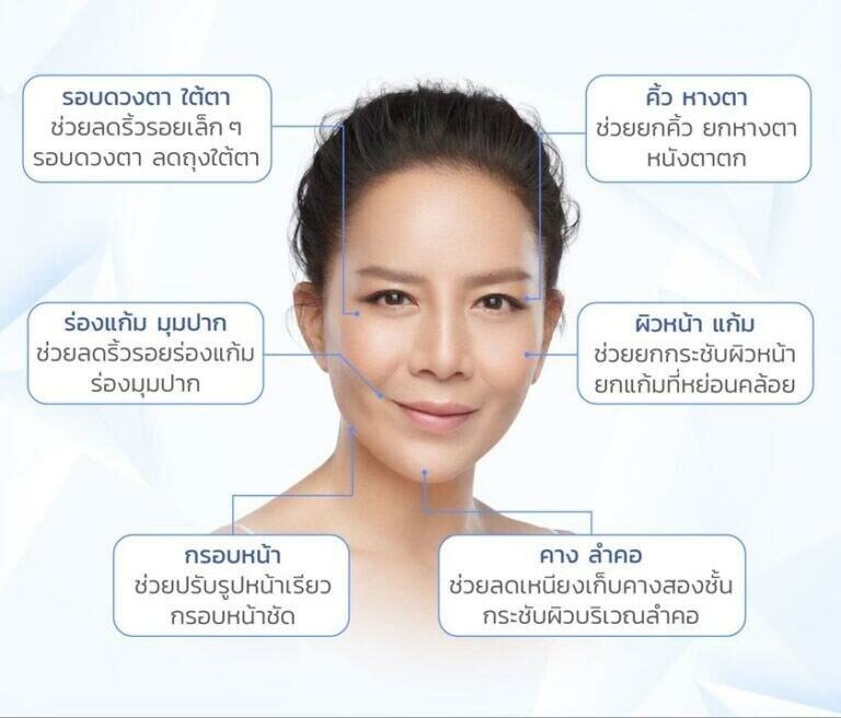 ตำแหน่ง ulthera