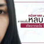 หนังตาตก ตาสองชั้นหลบในเกิดจากอะไร? จะแก้ปัญหาอย่างไรดี