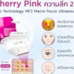 Ultraformer iii นวัตกรรมยกกระชับ ปรับรูปหน้า แบบไม่ต้องผ่าตัด 