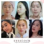 หนังตาตก ตาสองชั้นหลบในเกิดจากอะไร? จะแก้ปัญหาอย่างไรดี