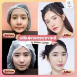 ส่องเทรนด์เกาหลีมาแรง ทรงคางแบบไหนที่กำลังฮิตปี 2023