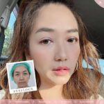 หนังตาตก ตาสองชั้นหลบในเกิดจากอะไร? จะแก้ปัญหาอย่างไรดี