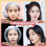 ส่องเทรนด์เกาหลีมาแรง ทรงคางแบบไหนที่กำลังฮิตปี 2023