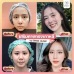 ส่องเทรนด์เกาหลีมาแรง ทรงคางแบบไหนที่กำลังฮิตปี 2023