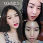 หนังตาตก ตาสองชั้นหลบในเกิดจากอะไร? จะแก้ปัญหาอย่างไรดี