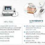 Ultraformer iii นวัตกรรมยกกระชับ ปรับรูปหน้า แบบไม่ต้องผ่าตัด 