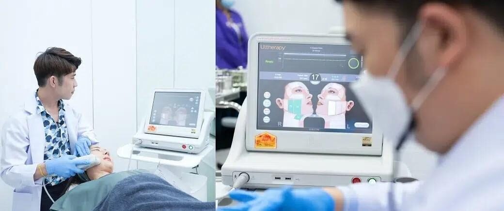 Ulthera SPT ที่ V Square Clinic Ulthera SPT ที่ V Square Clinic