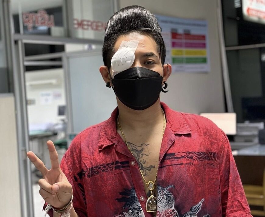 เก่ง ธชย เยื่อบุตาขาวอักเสบ