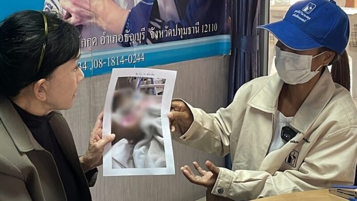 ทับลูก