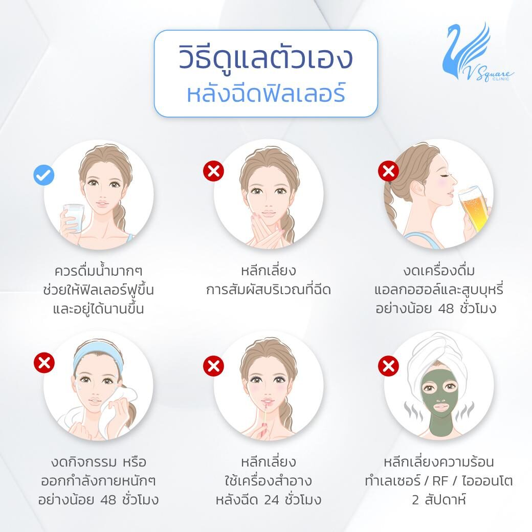วิธีดูแลตัวเองหลังฉีดฟิลเลอร์