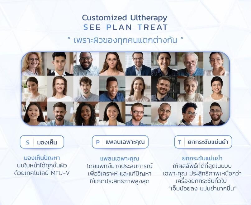 Ulthera SPT Ulthera SPT