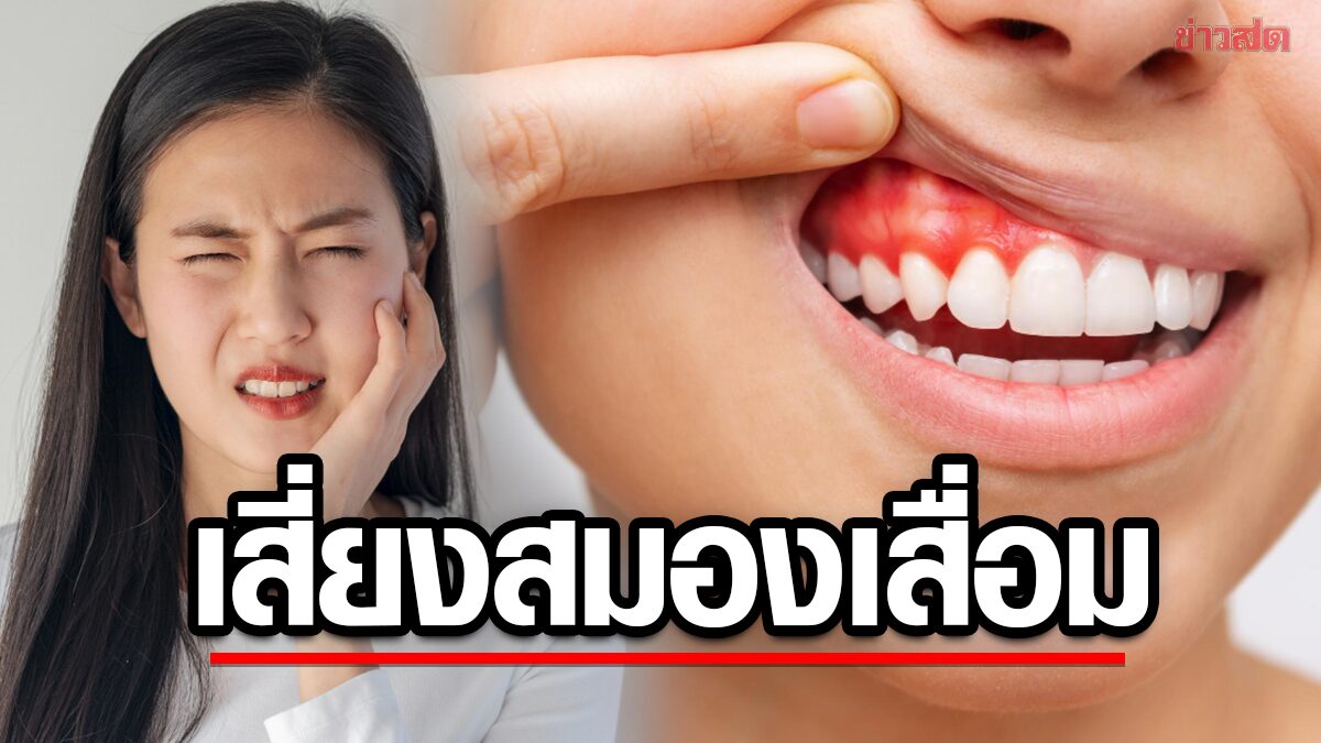 The Connection Between Gingivitis and Dementia US Research Reveals