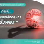 แพทย์ห่วง! “หลอดเลือดสมองโป่งพอง” มรดก ‘โรค’ ญาติสายตรง