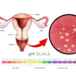 ปรับสมดุล PH ในช่องคลอด เพิ่มโอกาสตั้งครรภ์ ด้วย “โพรไบโอติกส์” 