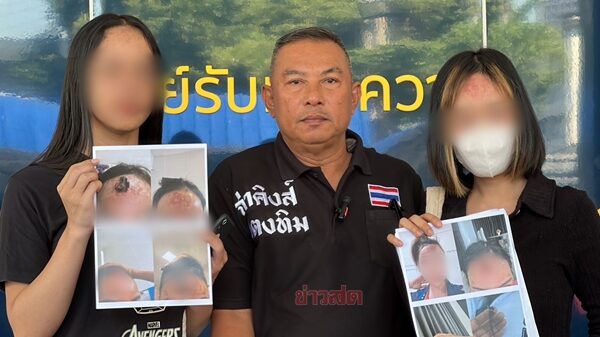 พริตตี้สาวรถหรู ร้อง บช.ก. เอาผิดคลินิกดังย่านปากเกร็ด หลังศัลยกรรมเปิดหน้าผาก เสริมดวง ทำเนื้อตายกลายเป็นแผล